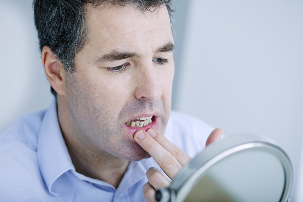 Very nice guy with dark hair grabbing lip looking at his mouth in a mirror