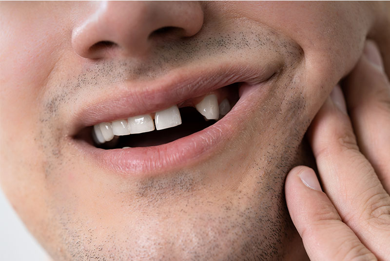 stock image of missing tooth